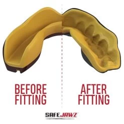SafeJawz Extro Goldie Mouth Guard -Knockout Shop safejawz extro goldie mouth guard 4 8450 p