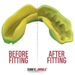 SafeJawz Extro Ogre Mouth Guard -Knockout Shop safejawz extro ogre mouth guard 4 8458 p