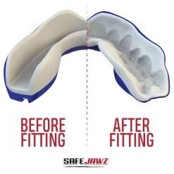 SafeJawz Extro Shark Mouth Guard -Knockout Shop safejawz extro shark mouth guard 4 8470 p