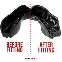 SafeJawz Intro Mouth Guard Black -Knockout Shop safejawz intro mouth guard black 3 8414 p